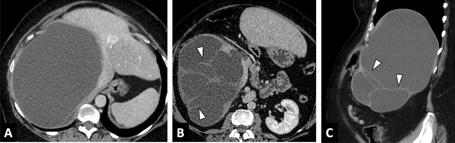 Fig. 15