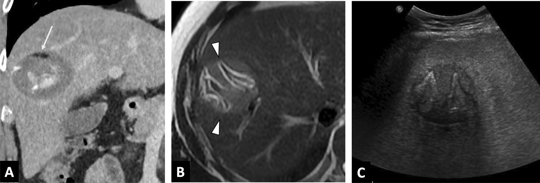 Fig. 16