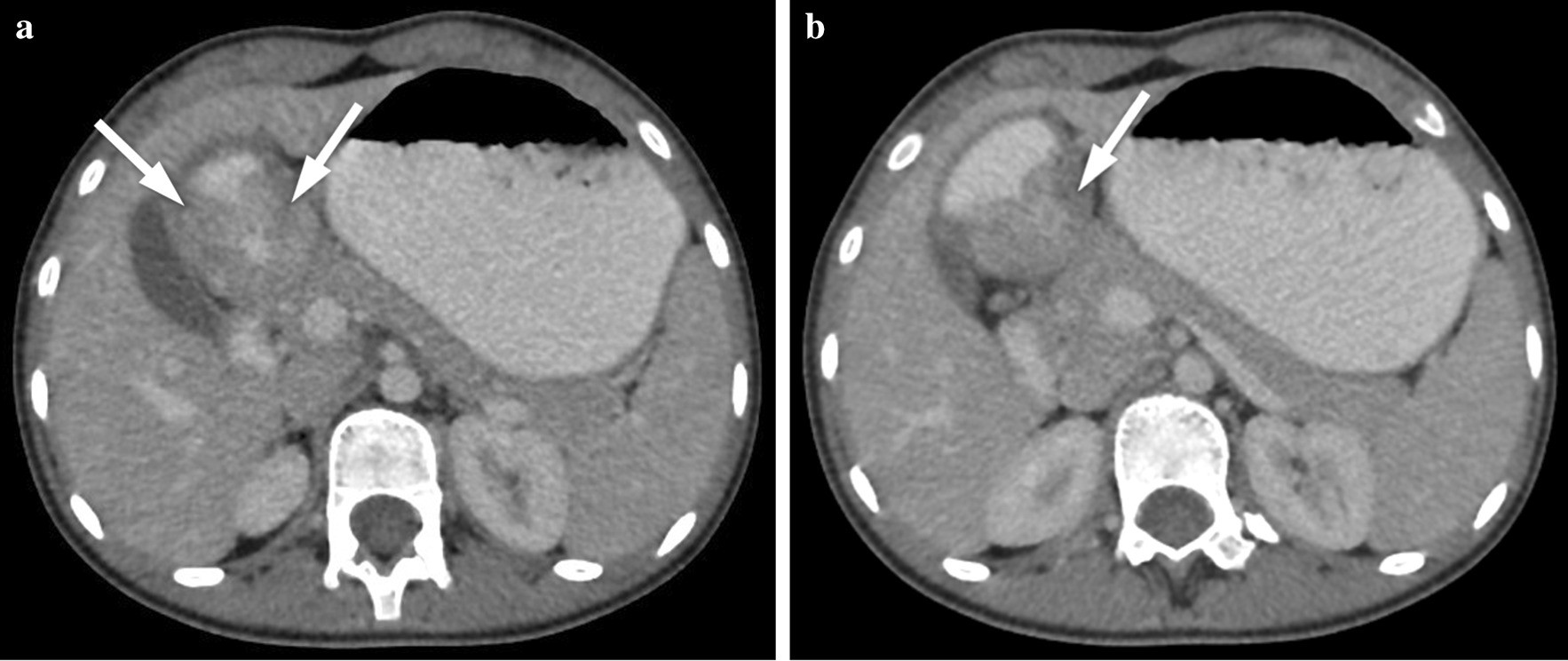 Fig. 10