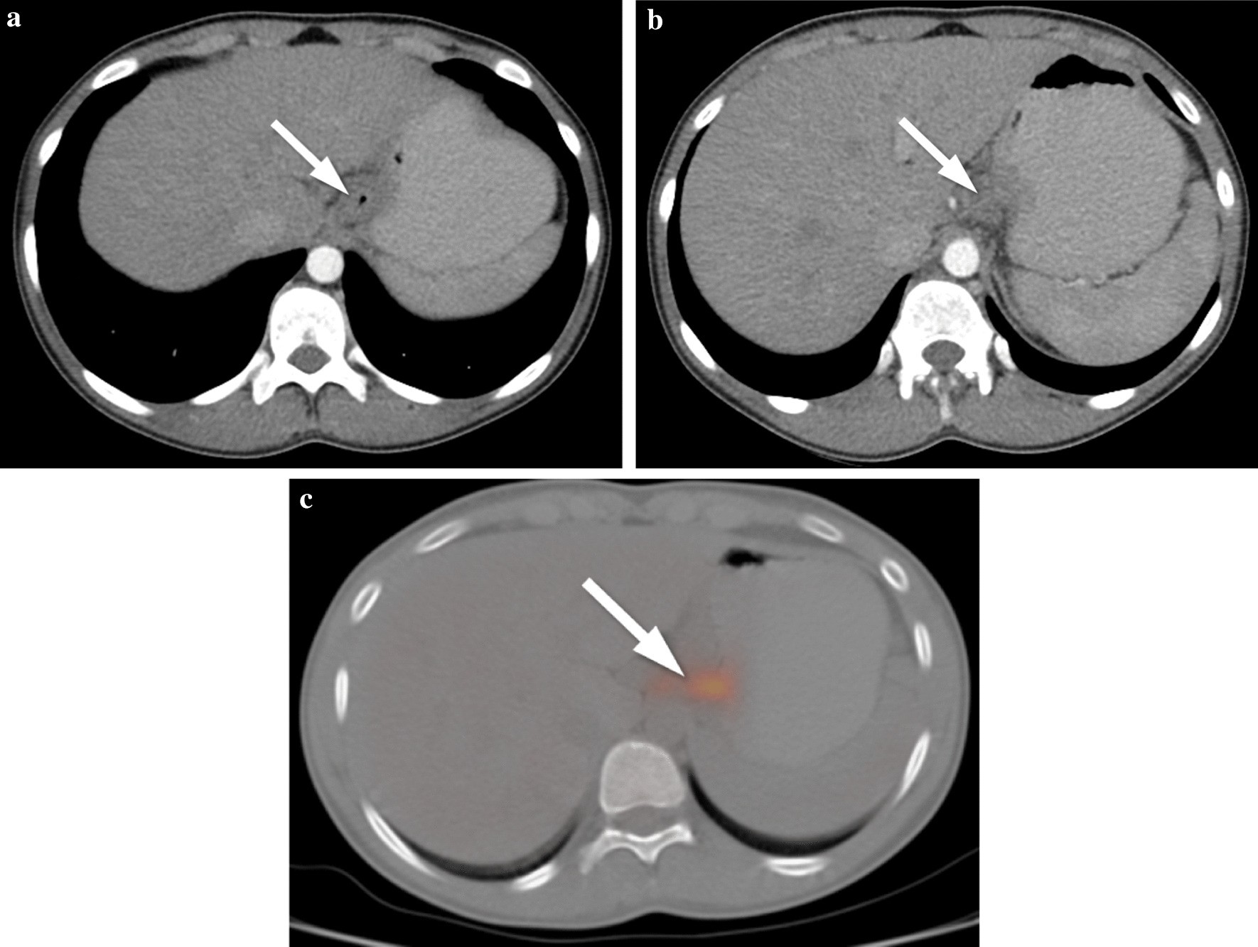 Fig. 15