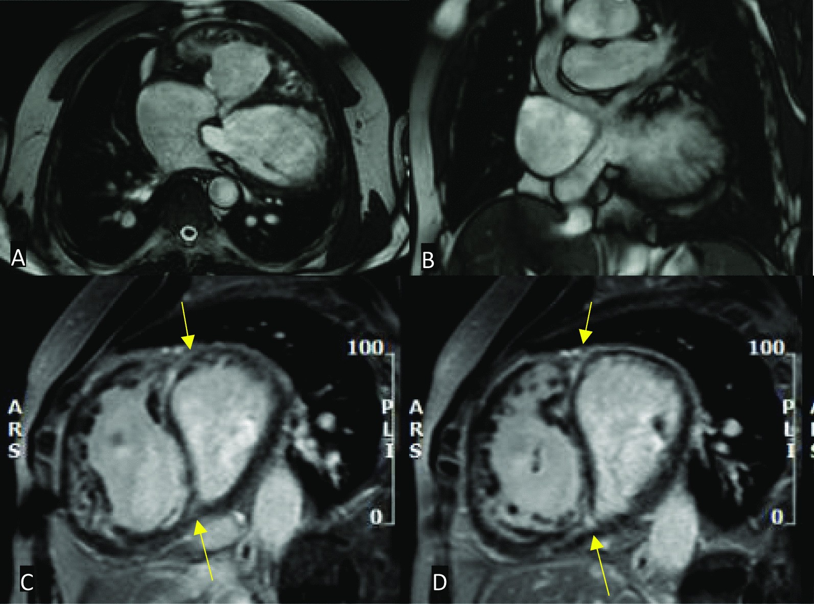 Fig. 11