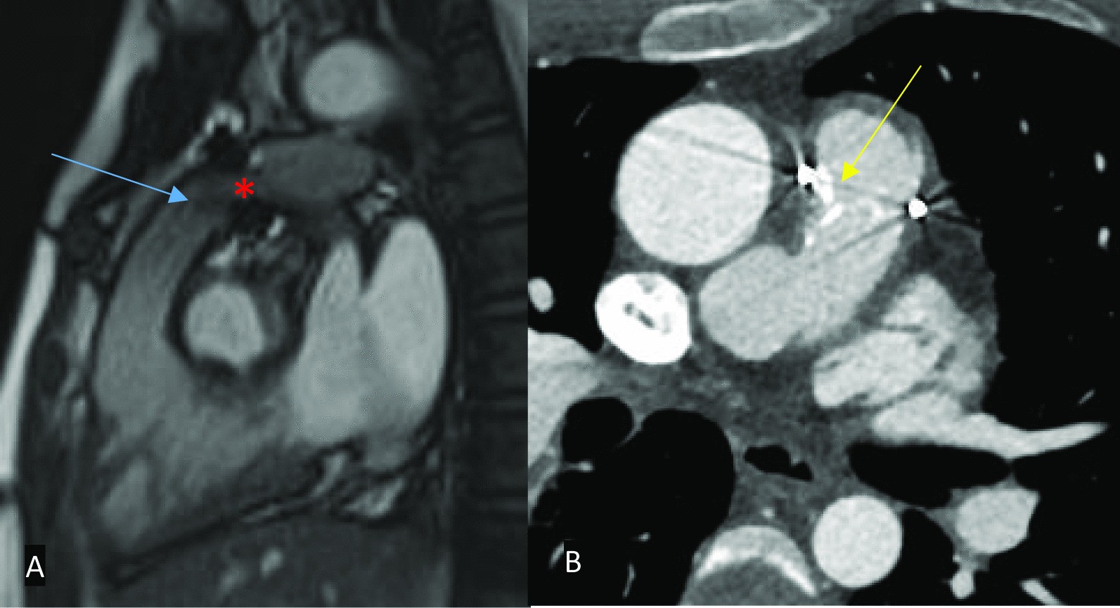 Fig. 17