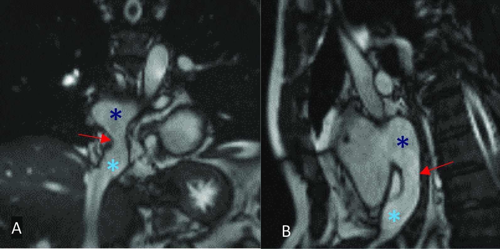 Fig. 20