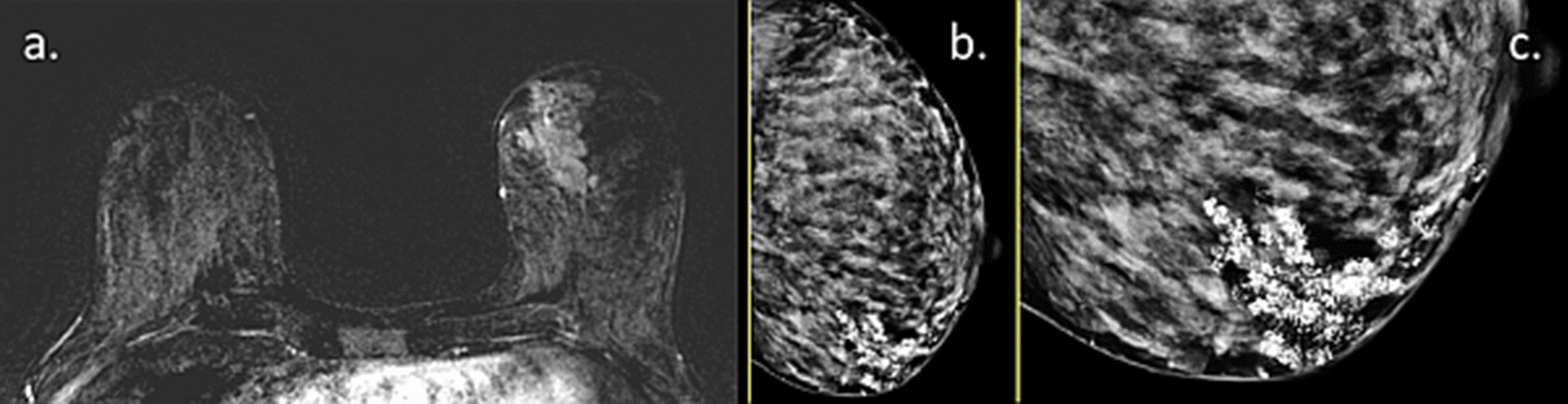 Fig. 16