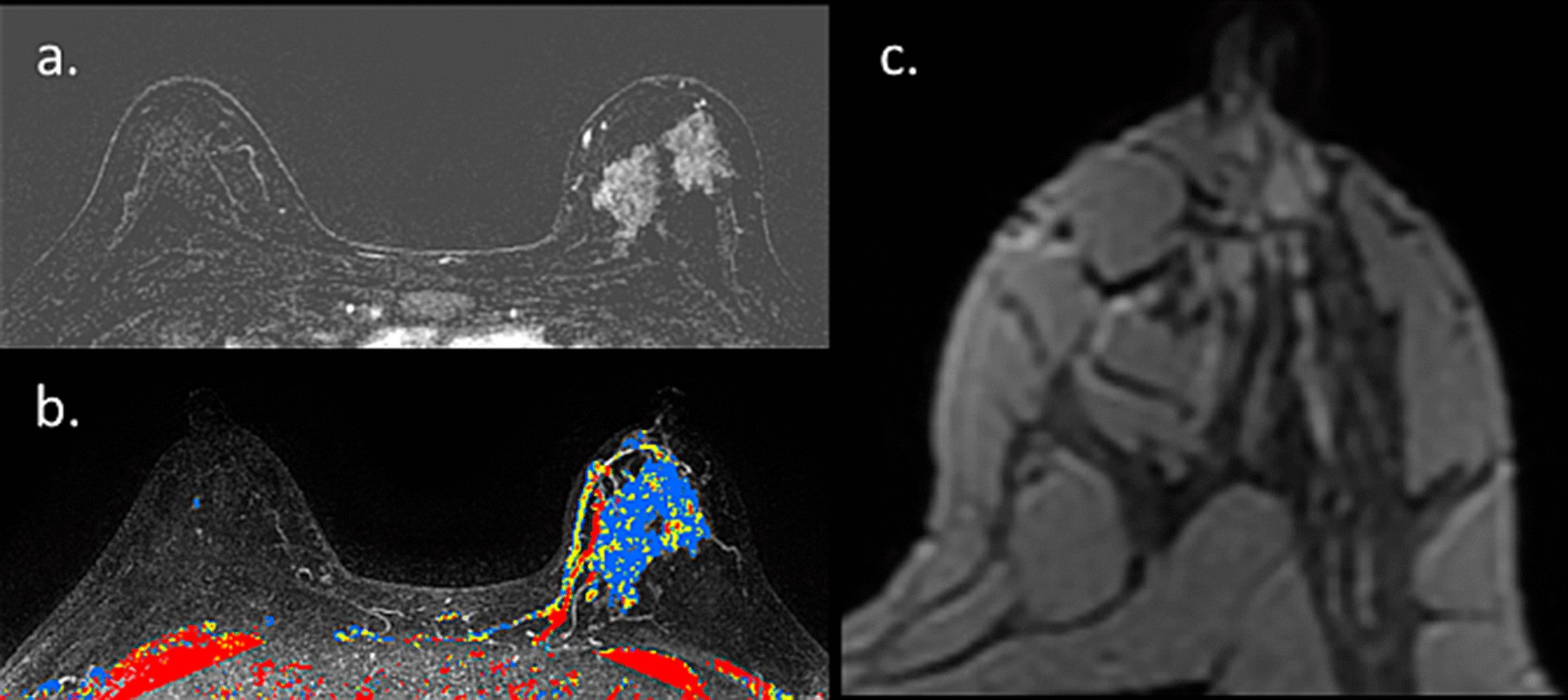 Fig. 20