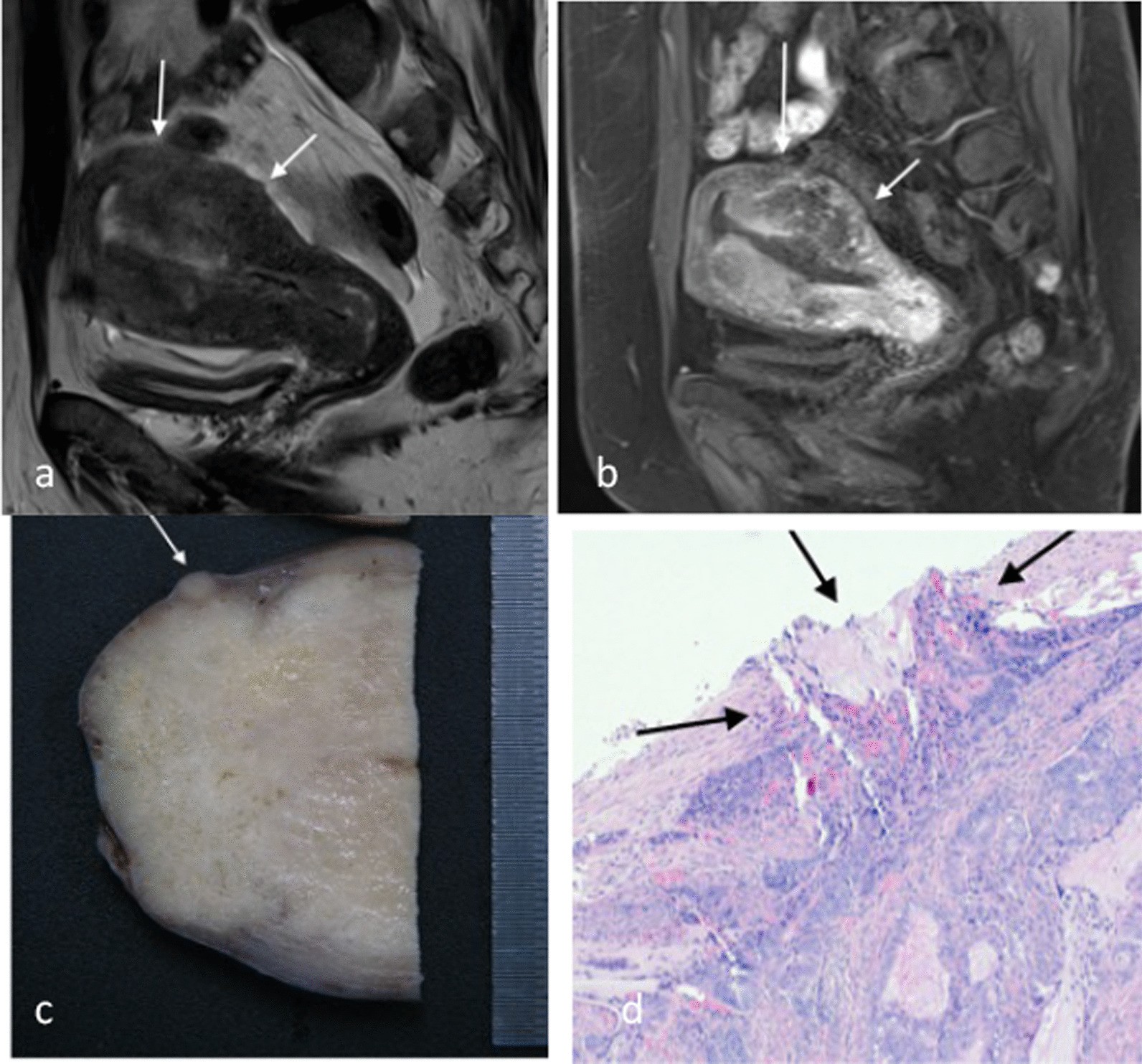 Fig. 12