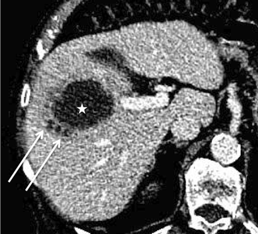 Fig. 26