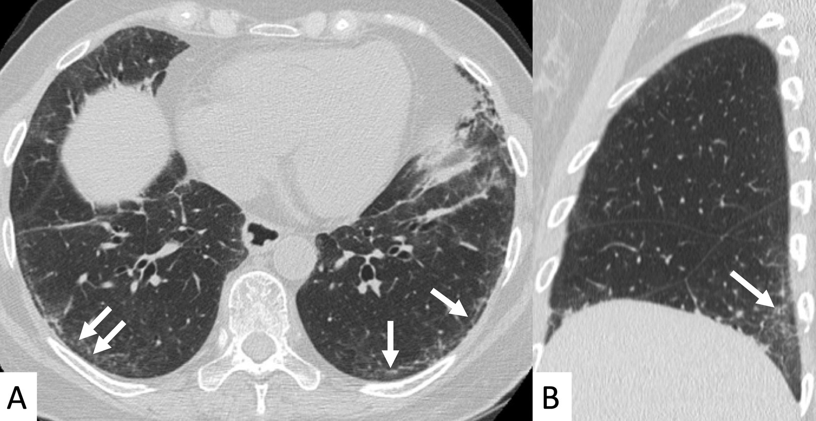 Fig. 10