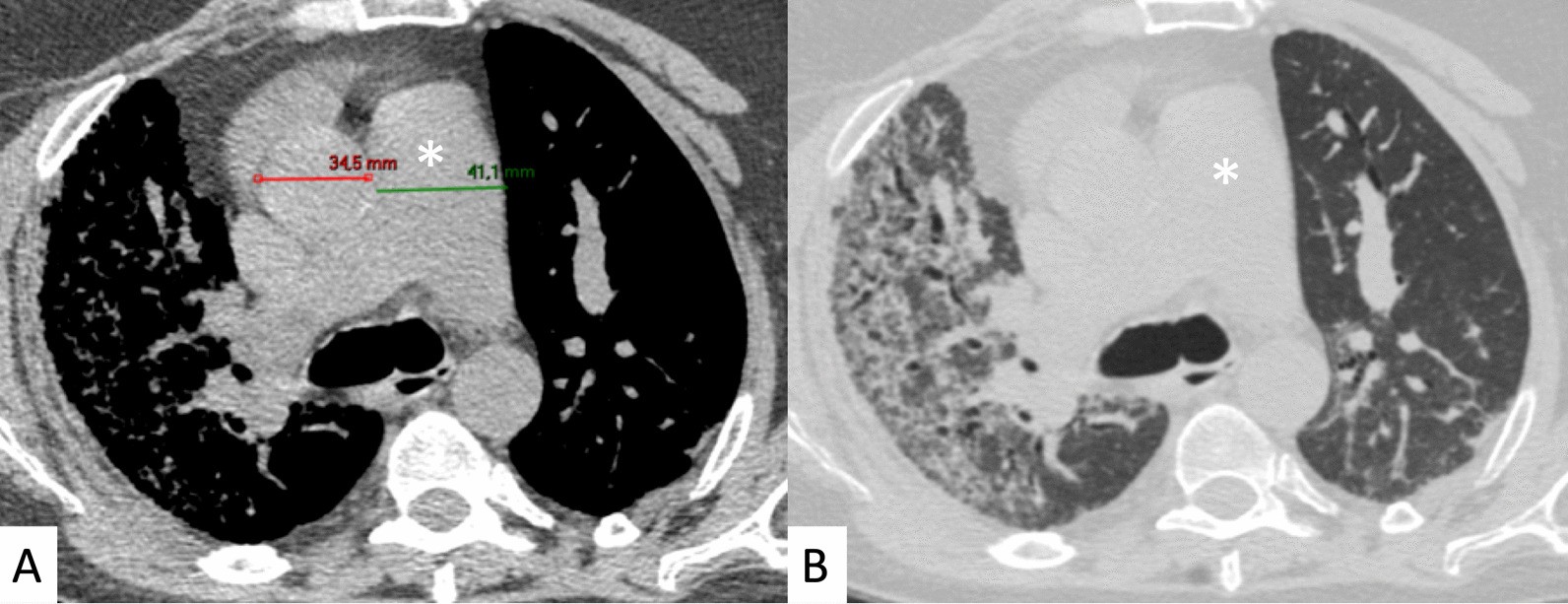 Fig. 13