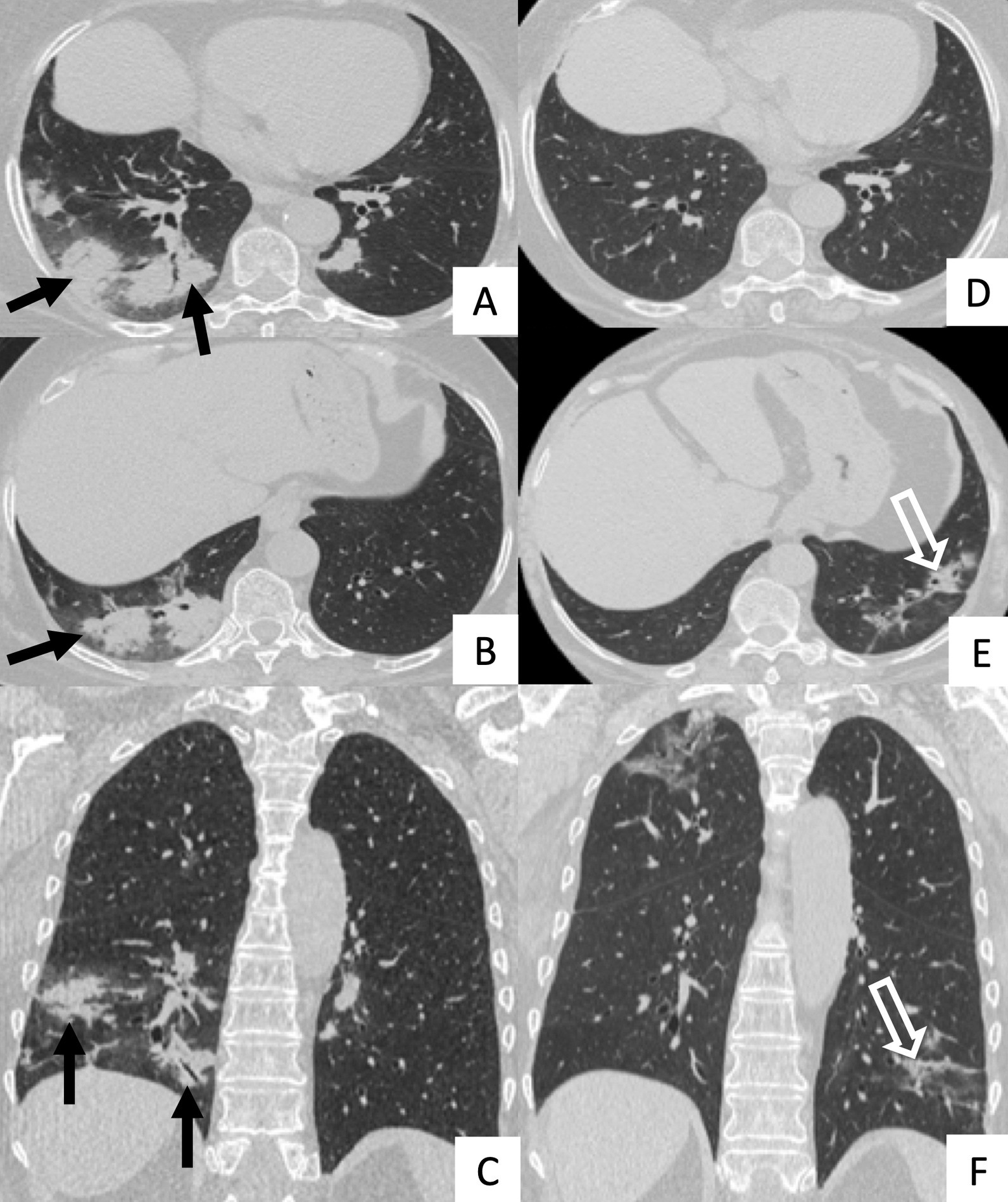 Fig. 17