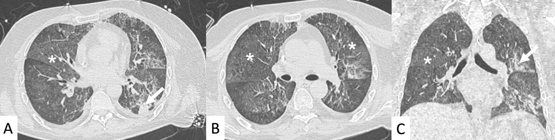 Fig. 20