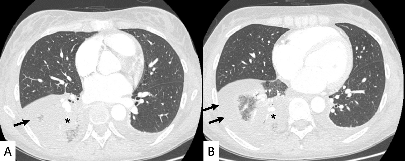 Fig. 21