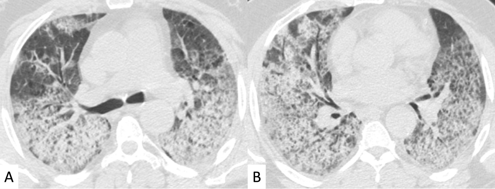 Fig. 22