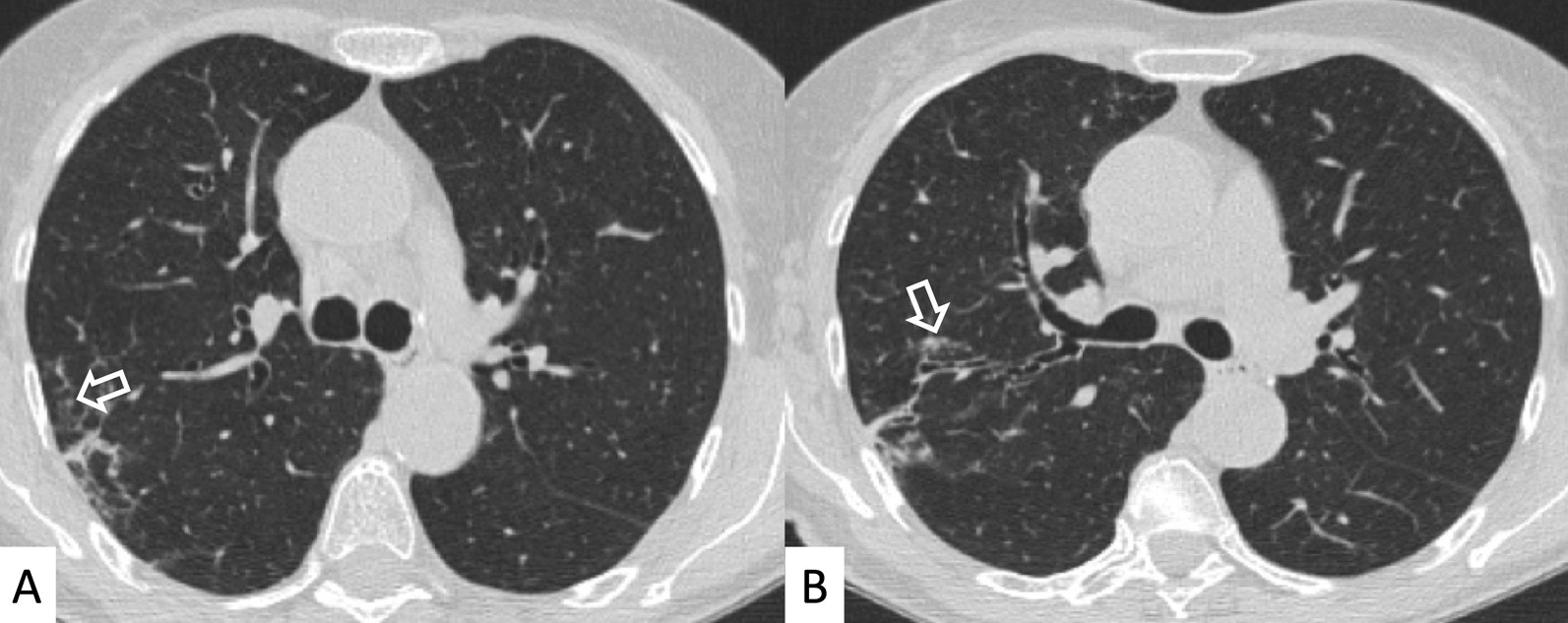 Fig. 24