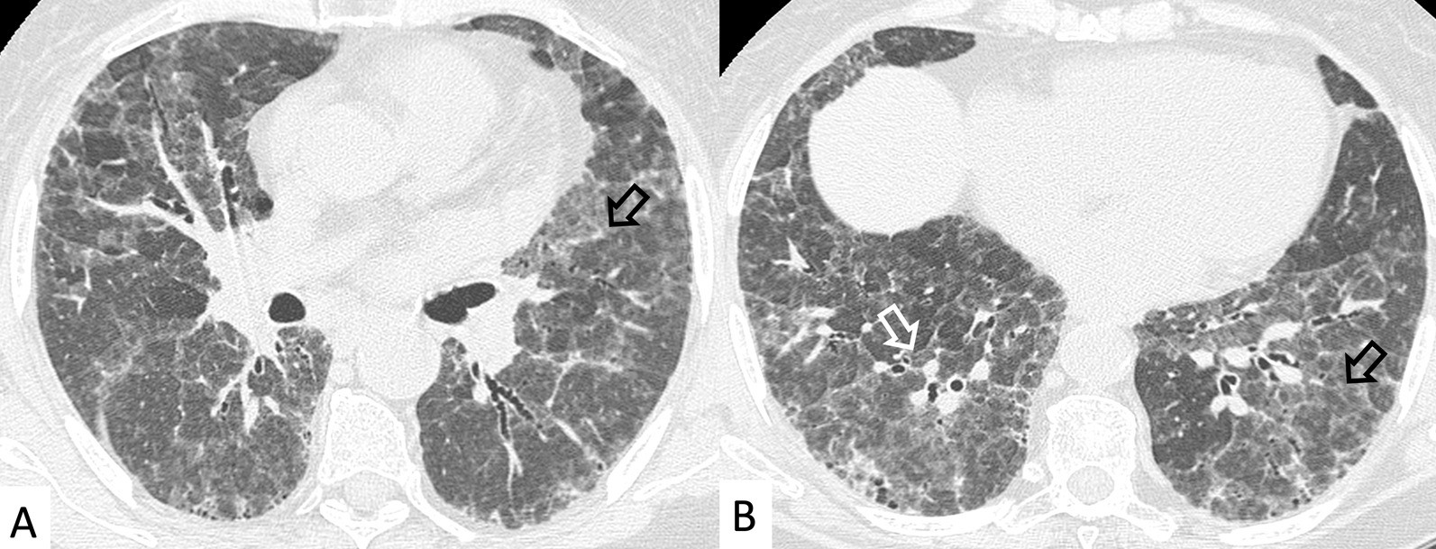 Fig. 29