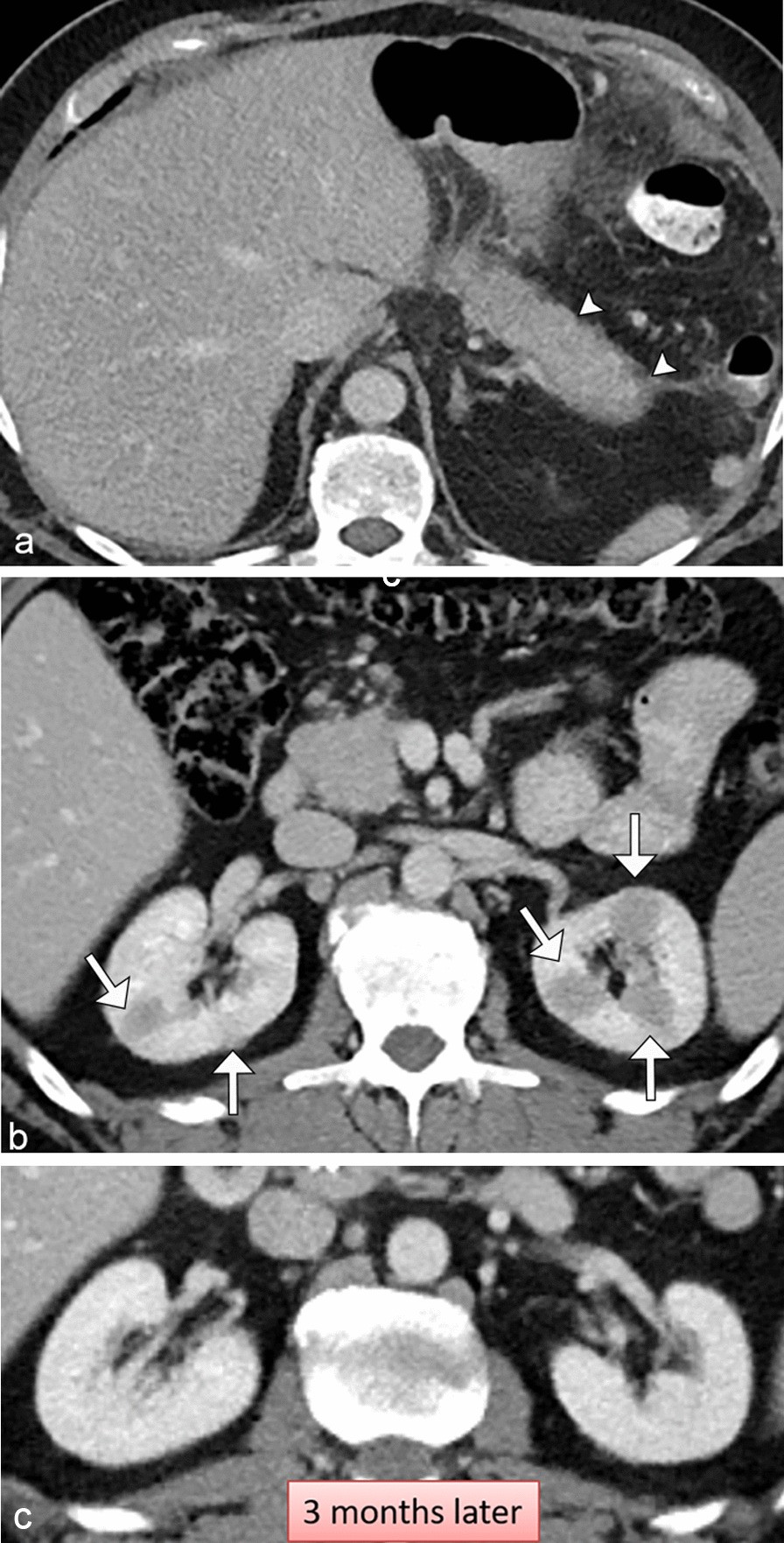 Fig. 11