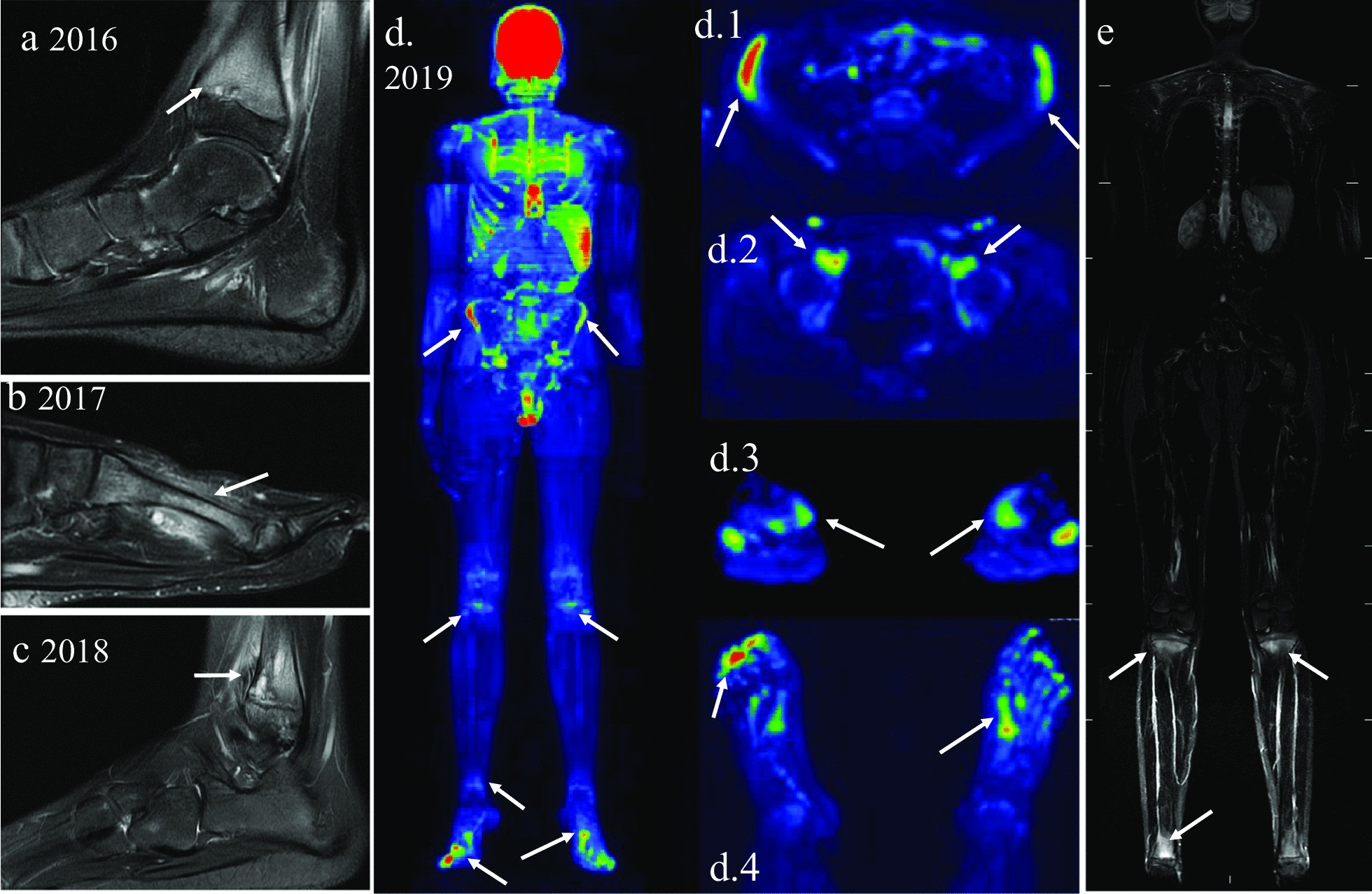 Fig. 12