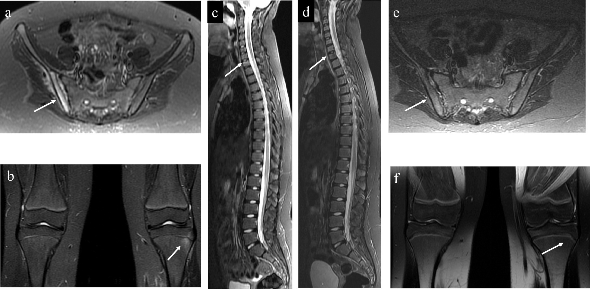 Fig. 13