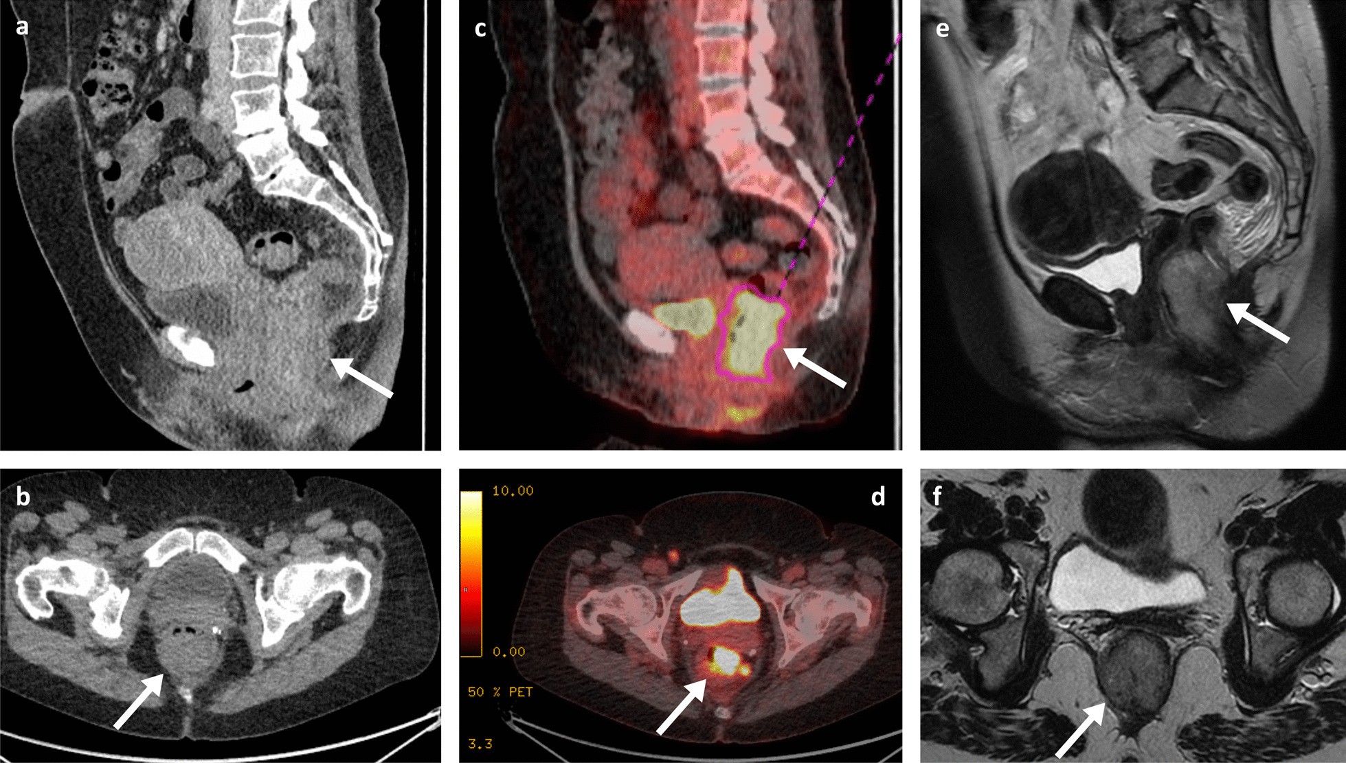 Fig. 10