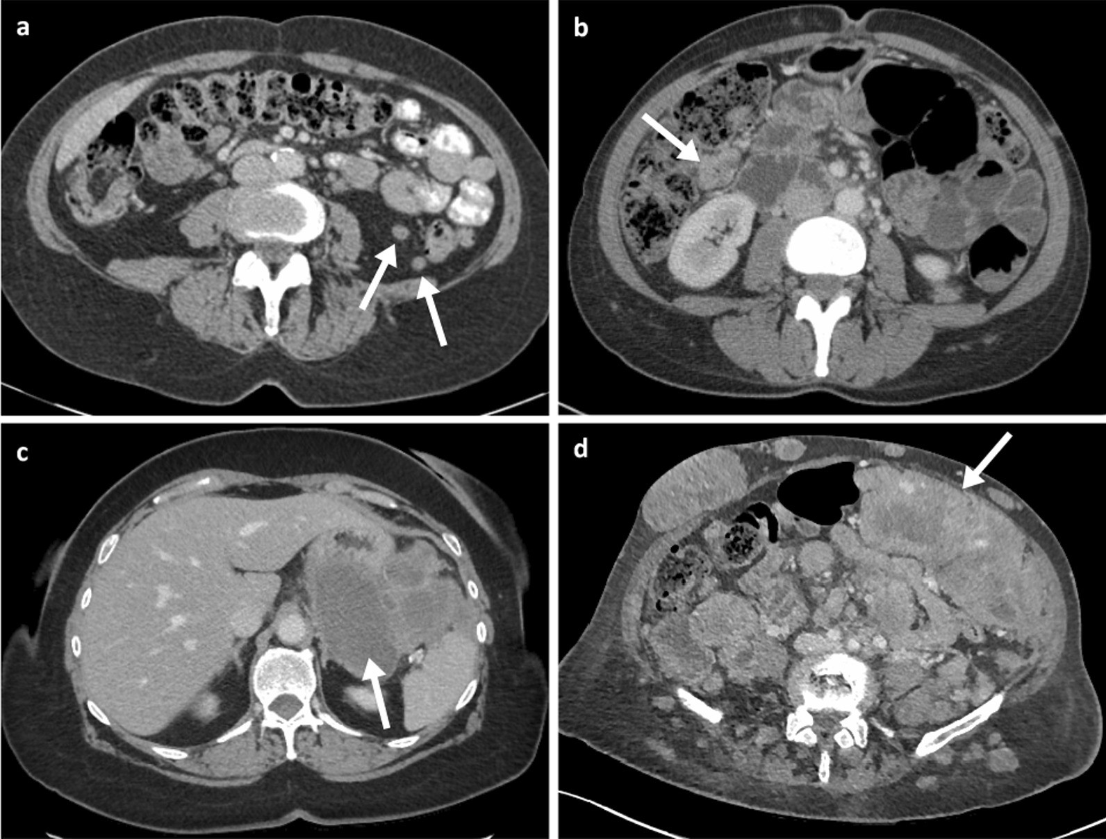 Fig. 15