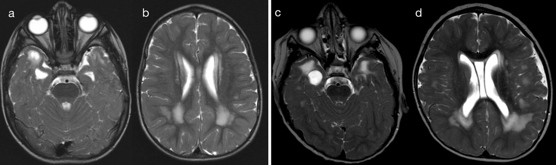 Fig. 13