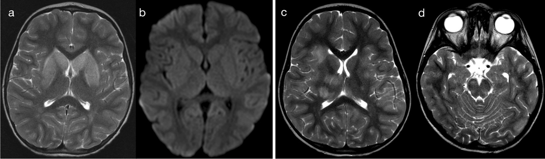 Fig. 14