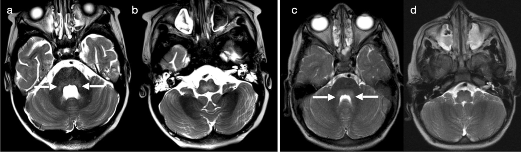 Fig. 16