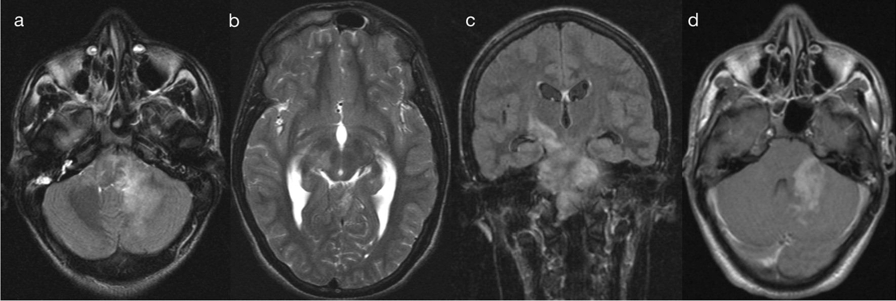 Fig. 17