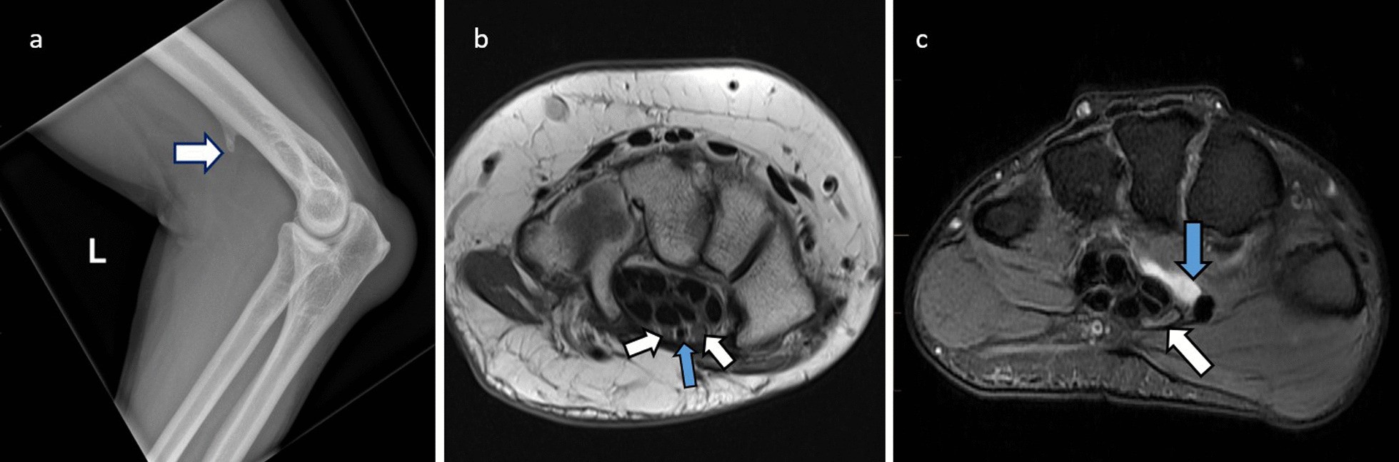 Fig. 11