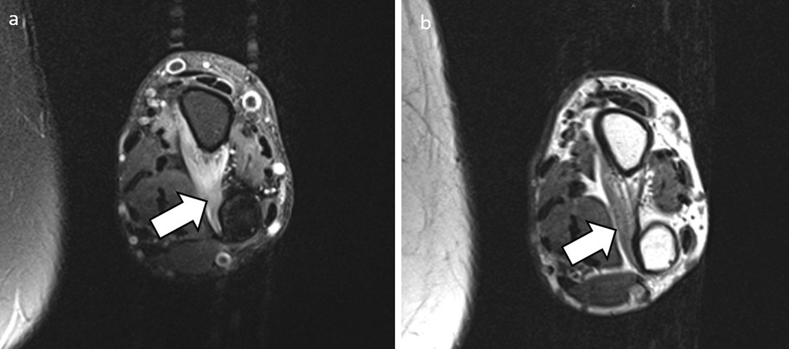 Fig. 13