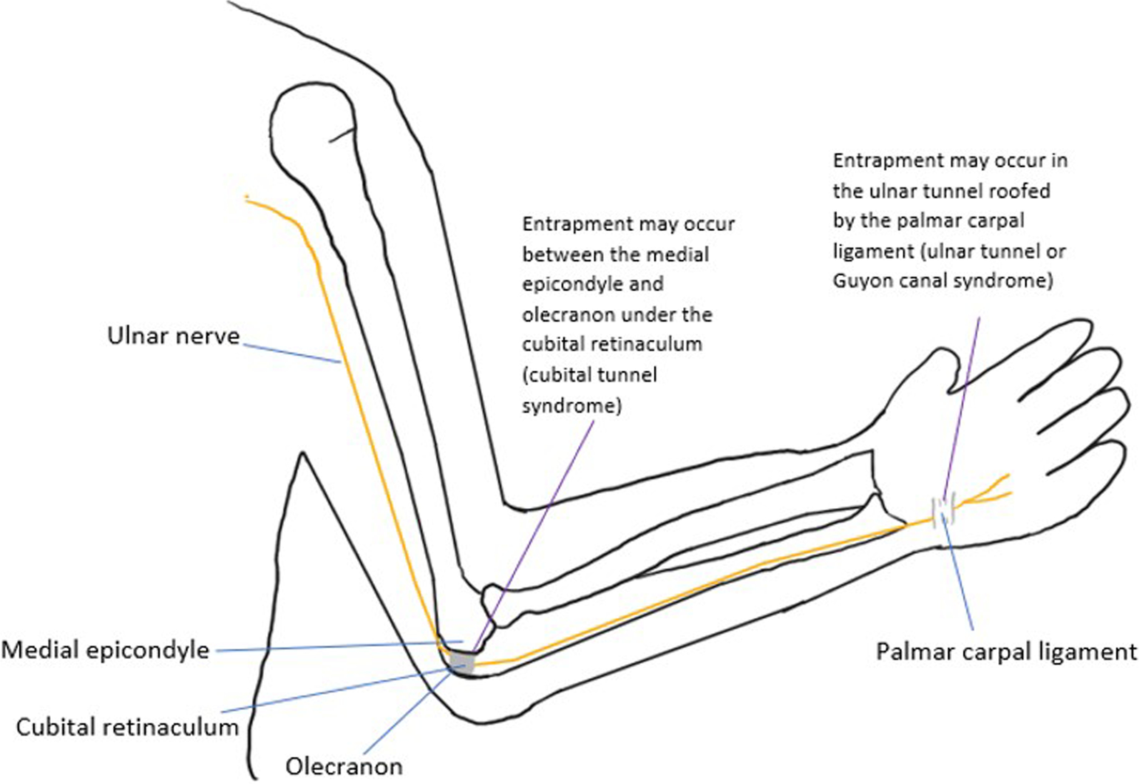 Fig. 14