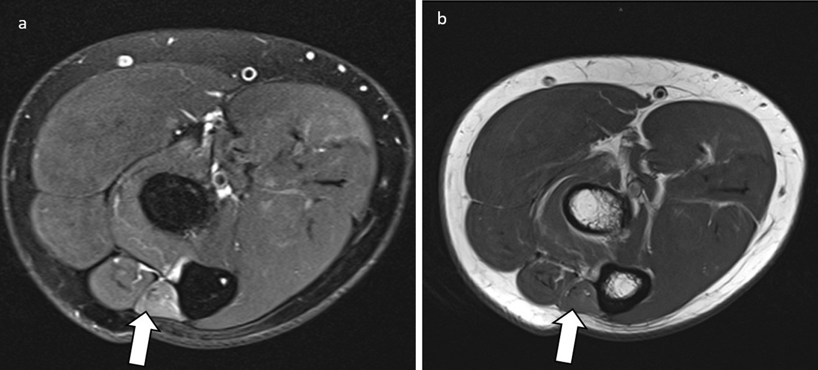 Fig. 9