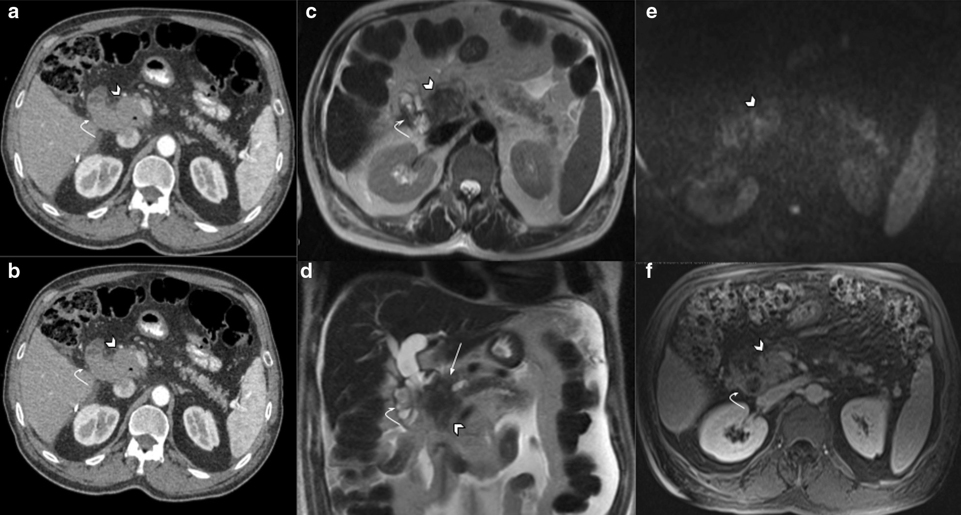 Fig. 10