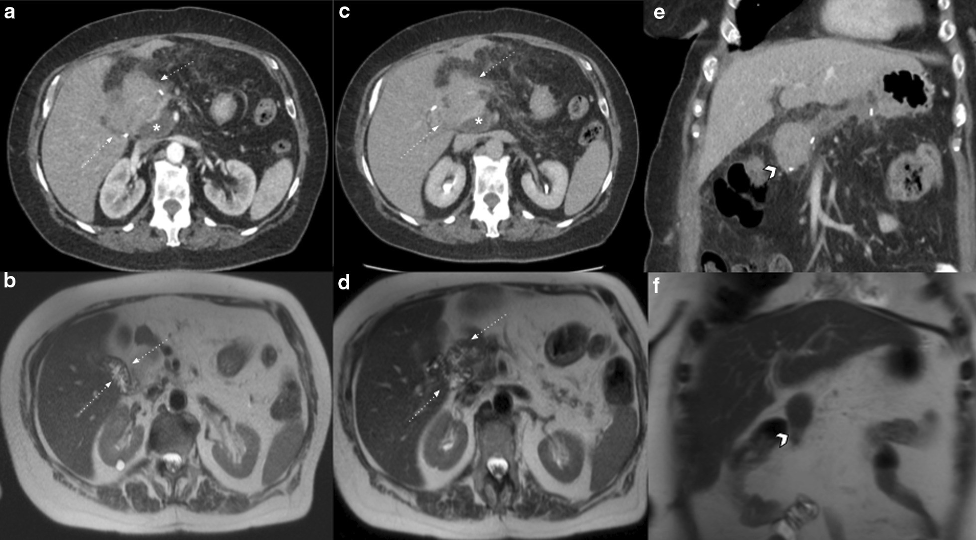 Fig. 11