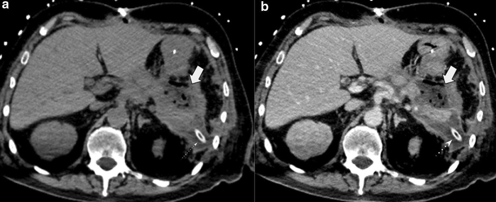 Fig. 16