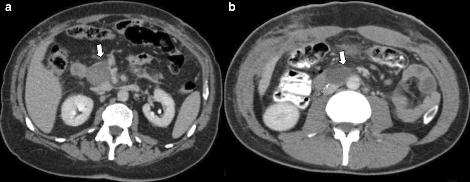 Fig. 17