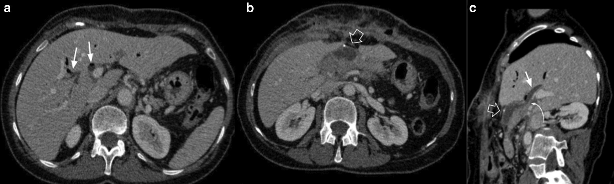 Fig. 19