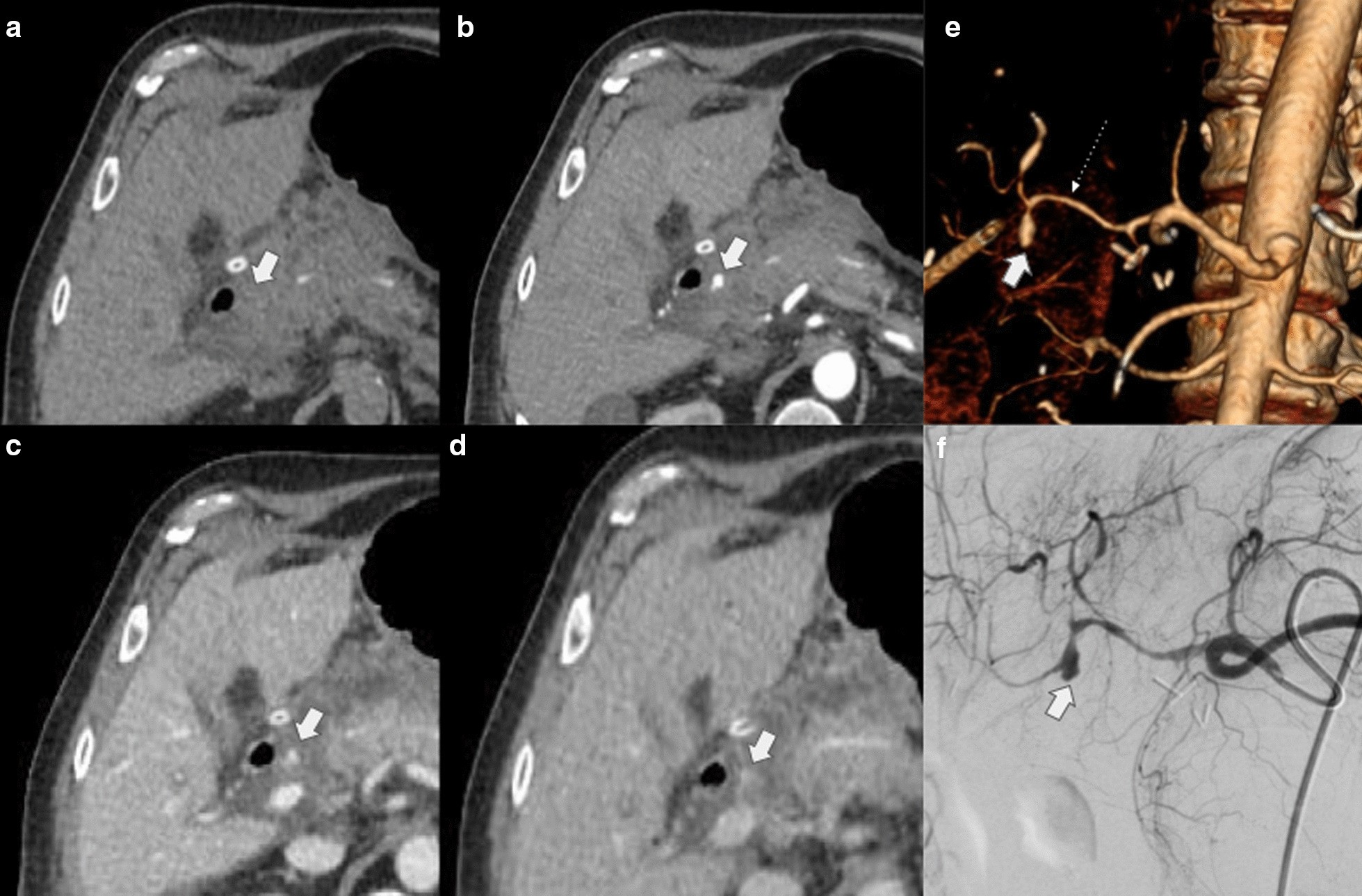 Fig. 27