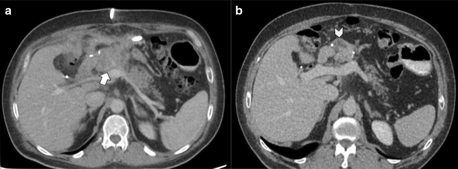 Fig. 9