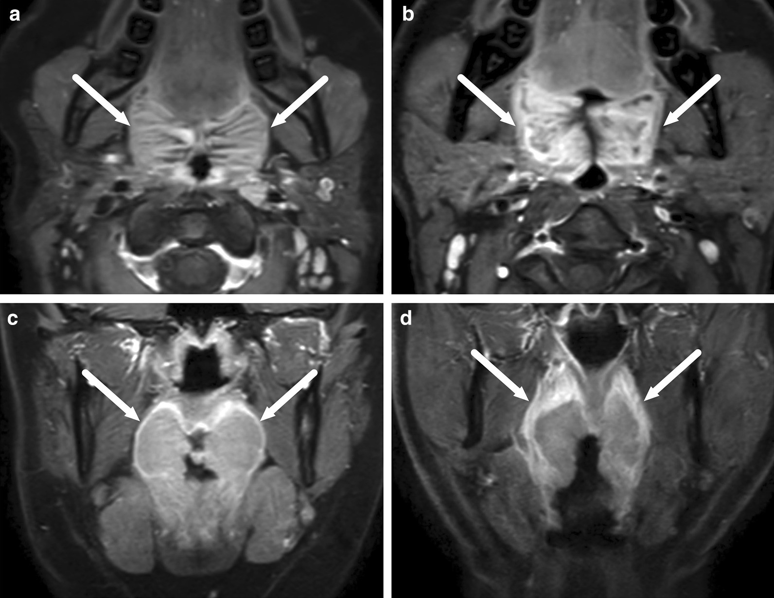 Fig. 13