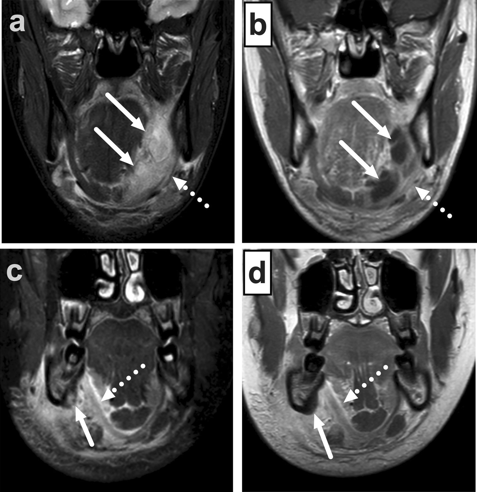 Fig. 17