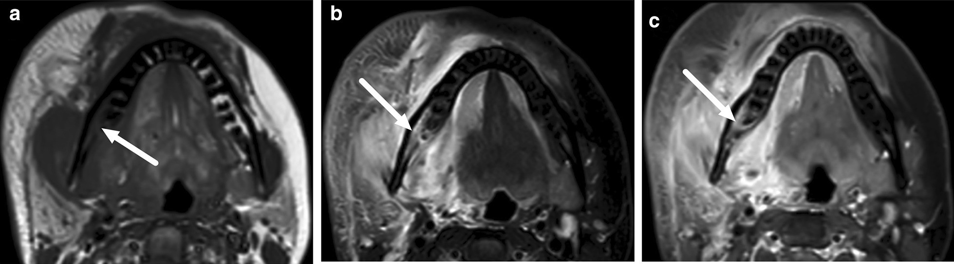 Fig. 19