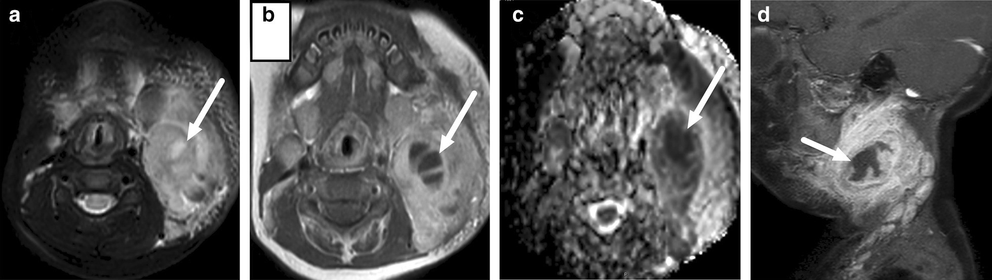 Fig. 22