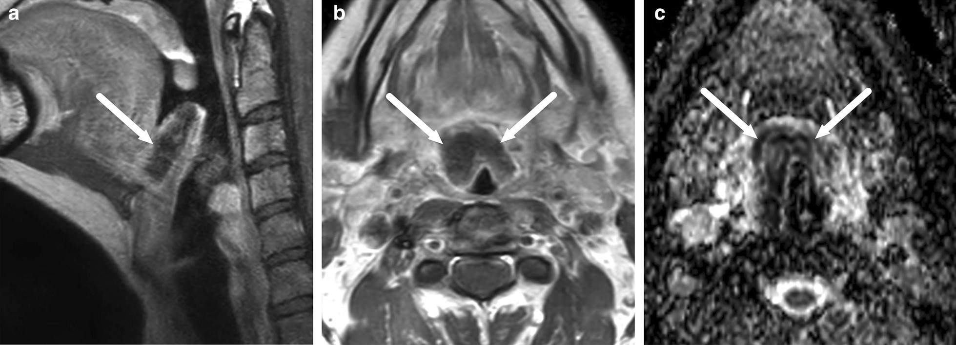 Fig. 24