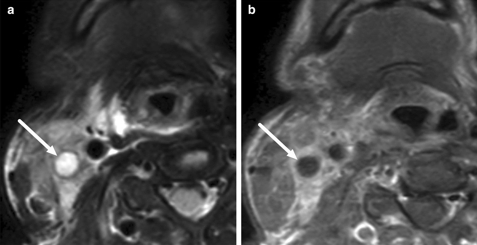 Fig. 27