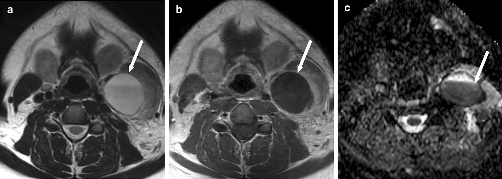 Fig. 31