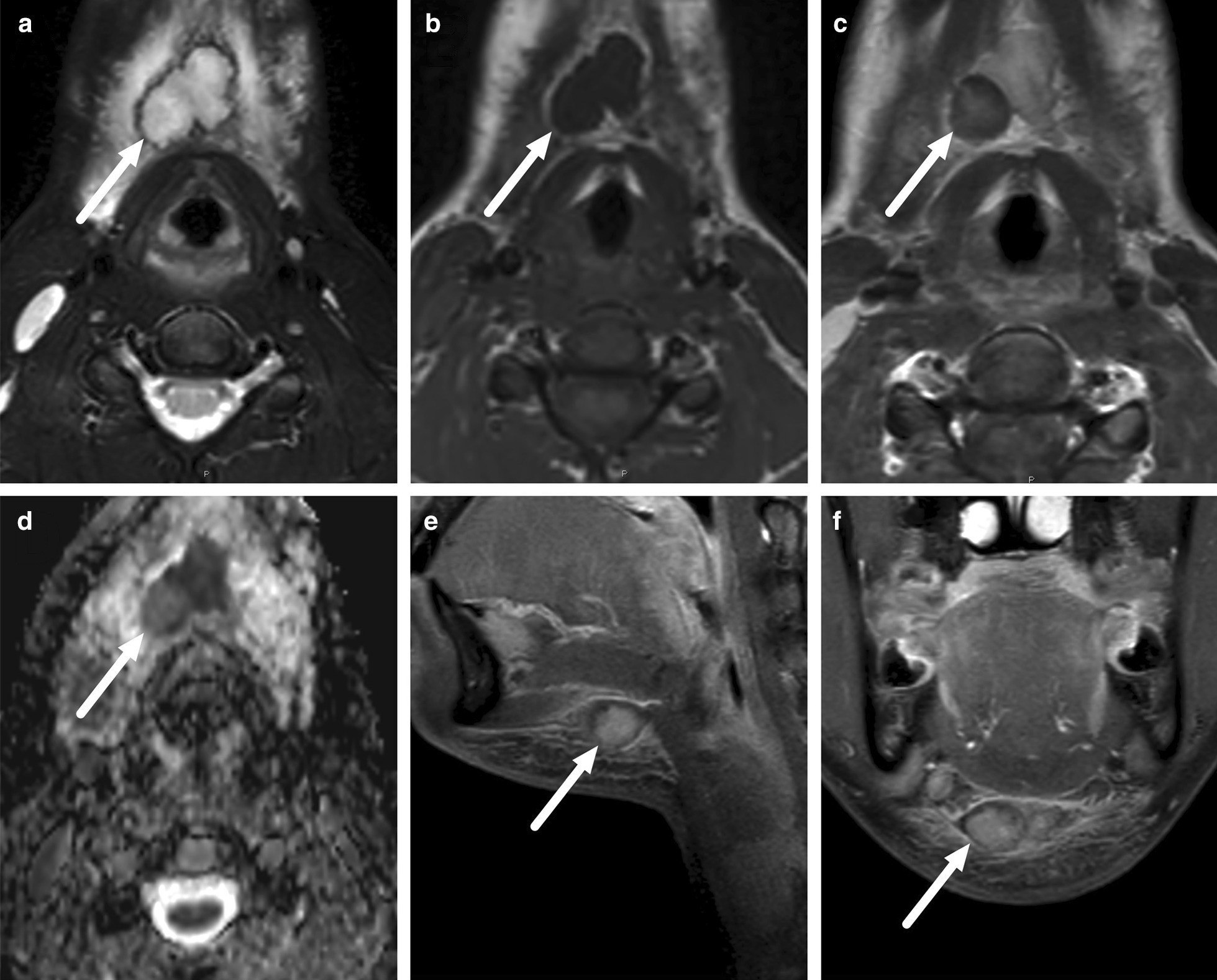 Fig. 34