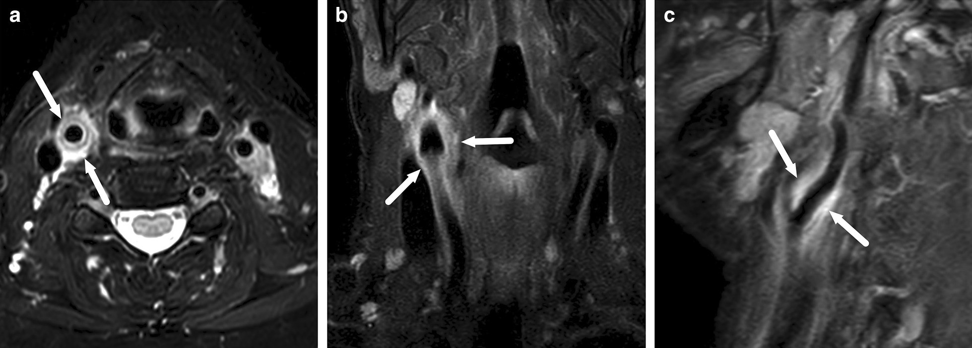 Fig. 37