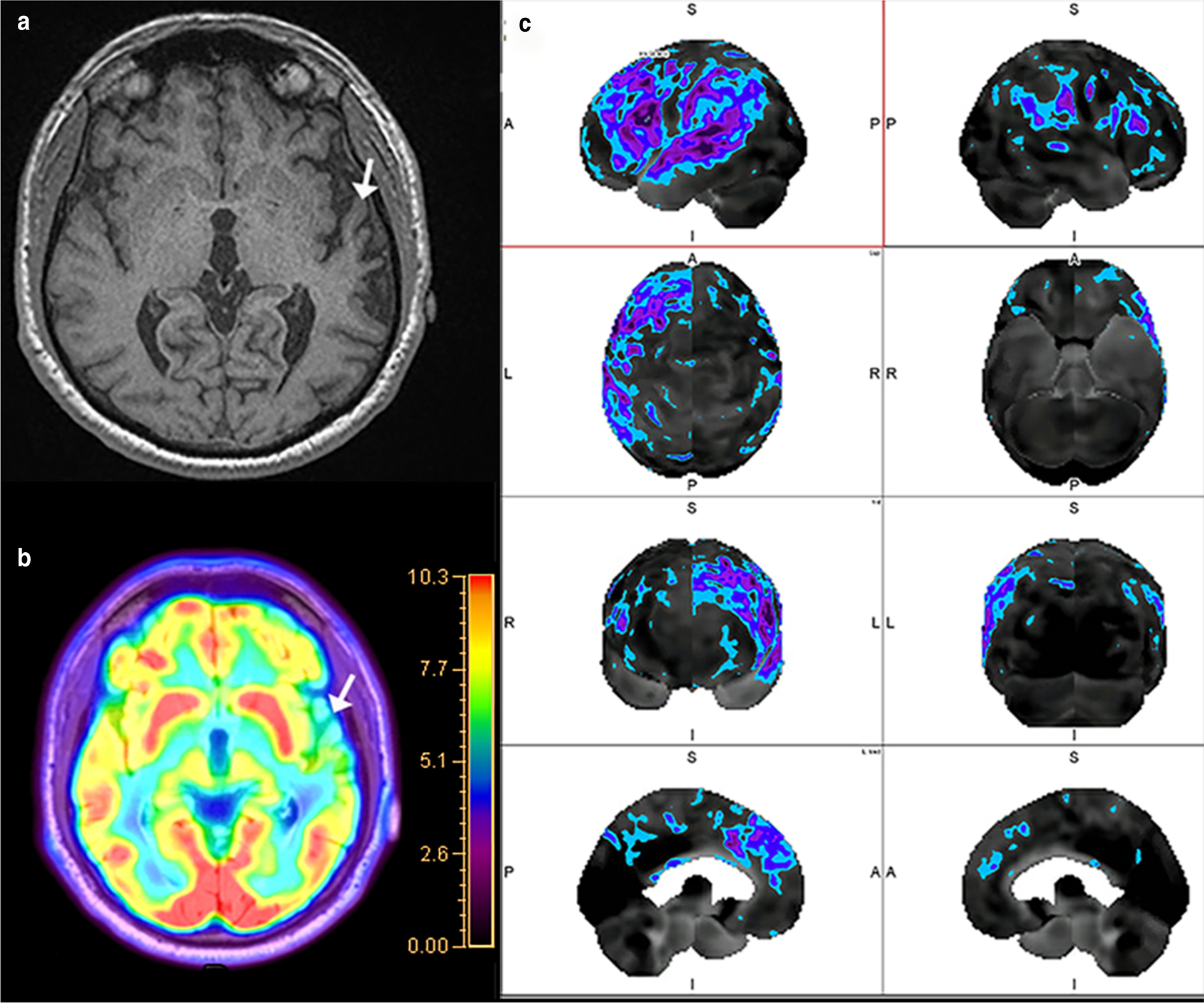 Fig. 13