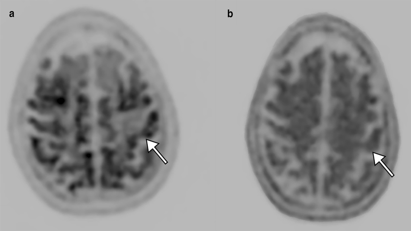 Fig. 17